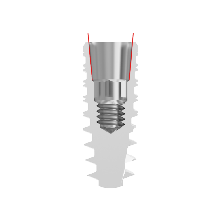 Visuel de l'implant LIKE I connectique similaire In-Kone® de la marque LIKE Implant, une marque d'astem