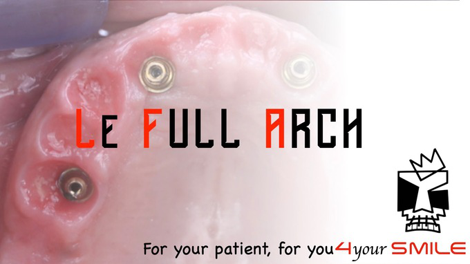 Visuel de la conférence de 4YourSmile Réhabilitation implanto-prothétique de l'édenté complet: Concept du Full-Arch
