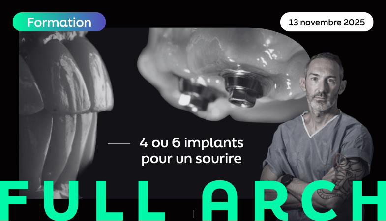 Visuel de la formation 4 ou 6 implants pour un sourire présentée par Matthieu collin