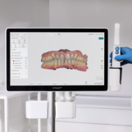 Visuel de l'écran du 3Shape TRIOS Move Pro
