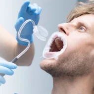 Écarteur buccal OptraGate Dry Control d'Ivoclar avec contrôle de l'humidité sans latex