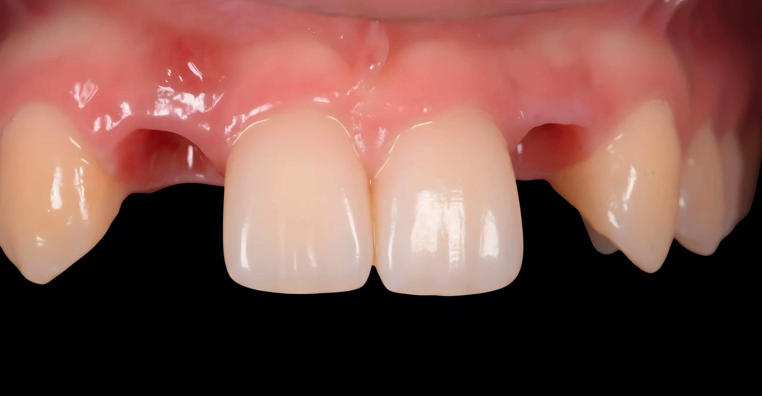 Cas clinique 1