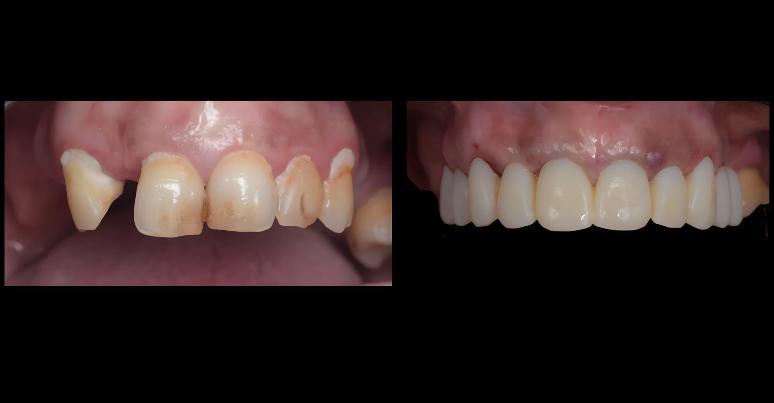 Cas clinique 2