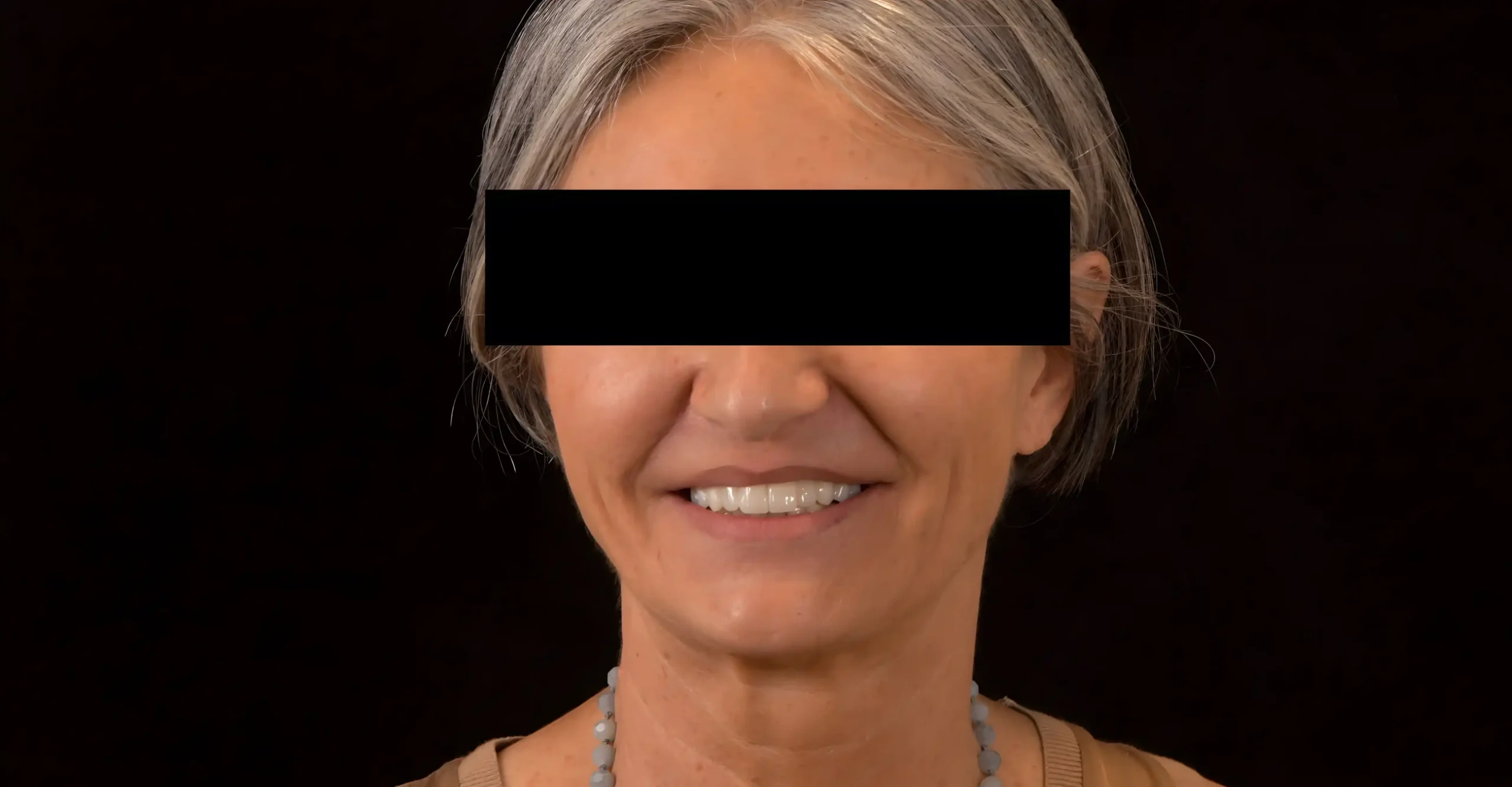 Cas clinique réalise par le Dr H. Buatois