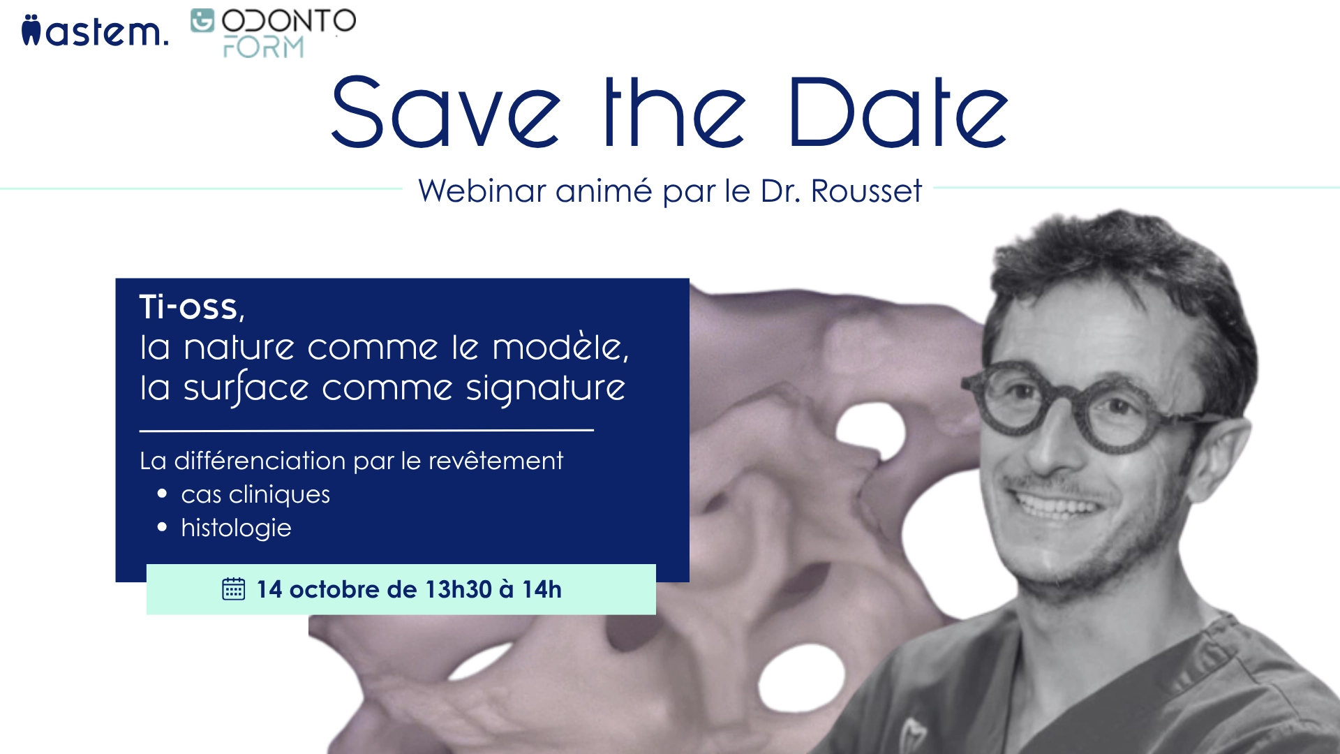 Webinar sur le Ti-oss avec le Dr. Rousset