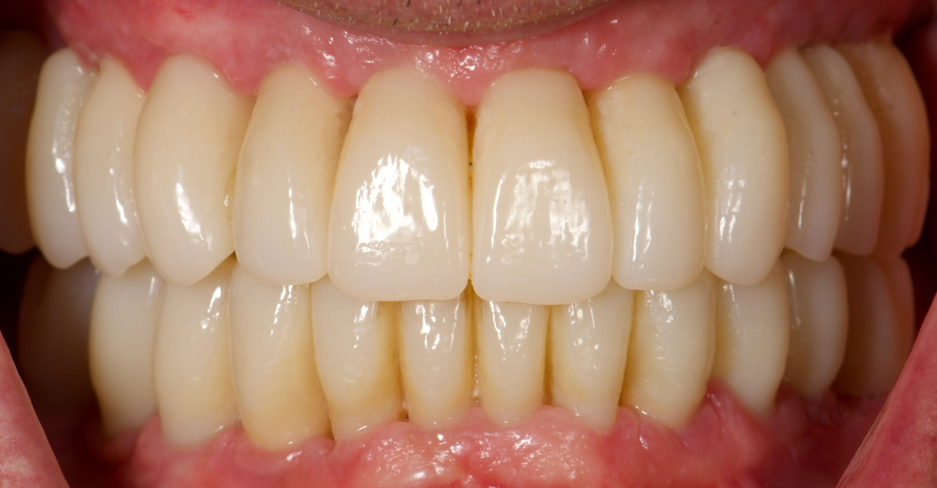 Cas clinique 3