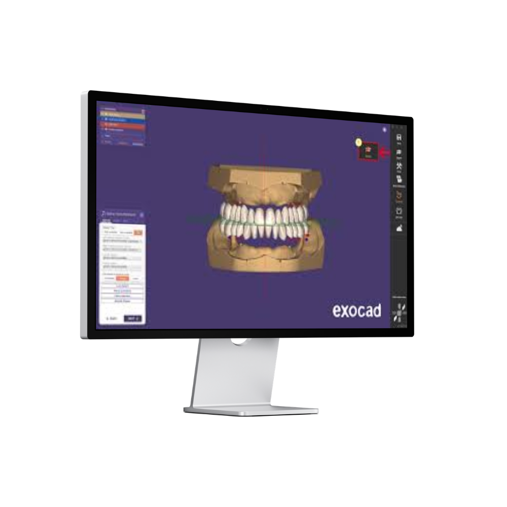 Visuel du logiciel Exocad