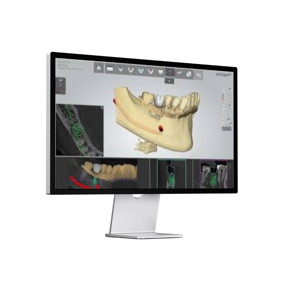 Visuel du logiciel Implant Studio