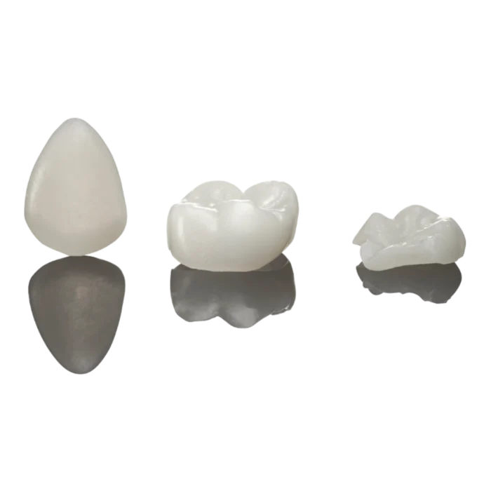 Boîte de 3 capsules unitaires SprintRay Midas Restore, résine de restauration définitive pour presse numérique Midas, teintes A1 à C2