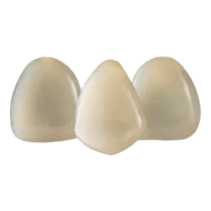 Boîte de 3 capsules unitaires SprintRay Midas Restore, résine de restauration définitive pour presse numérique Midas, teintes A1 à C2