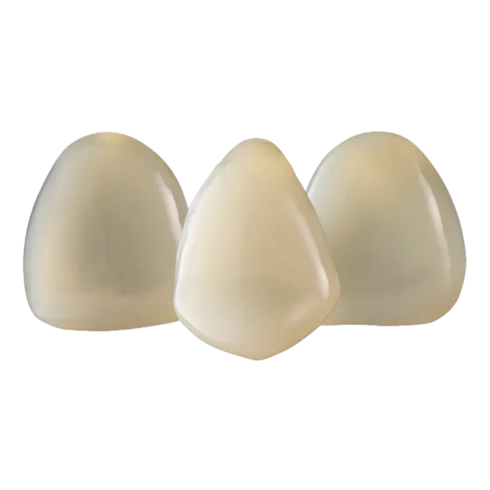 Boîte de 3 capsules unitaires SprintRay Midas Restore, résine de restauration définitive pour presse numérique Midas, teintes A1 à C2
